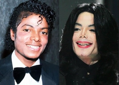 A picture of Michael Jackson before (left) and after (right).